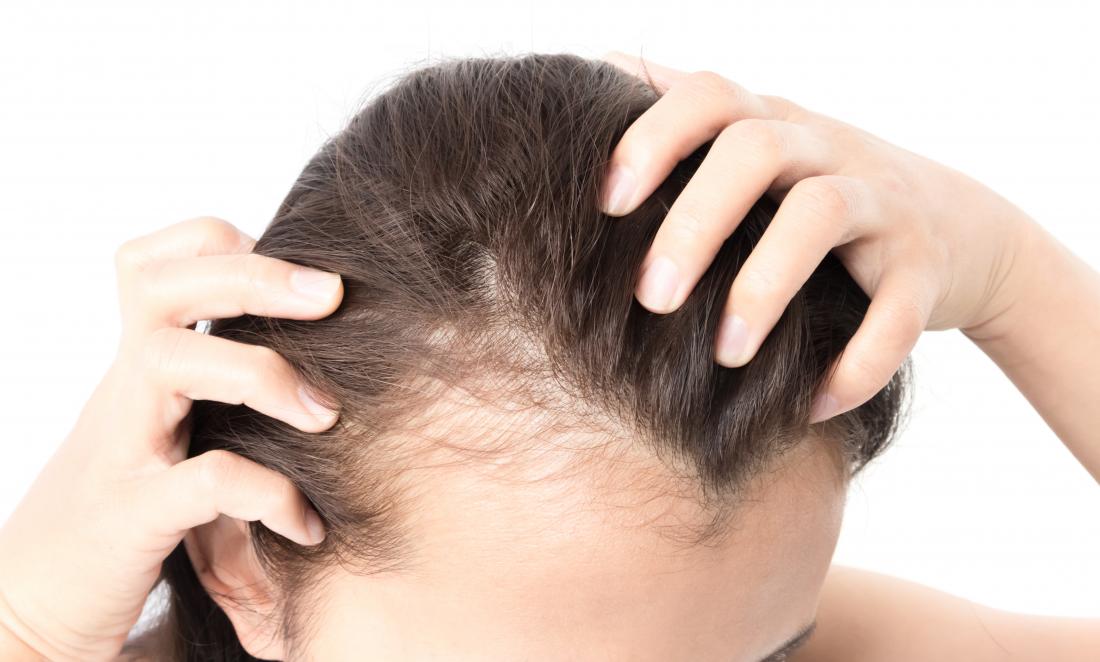 Can Masturbation Cause Hair Loss?